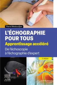 L'échographie pour tous : apprentissage accéléré