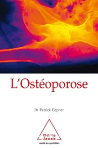 ostéoporose (L')